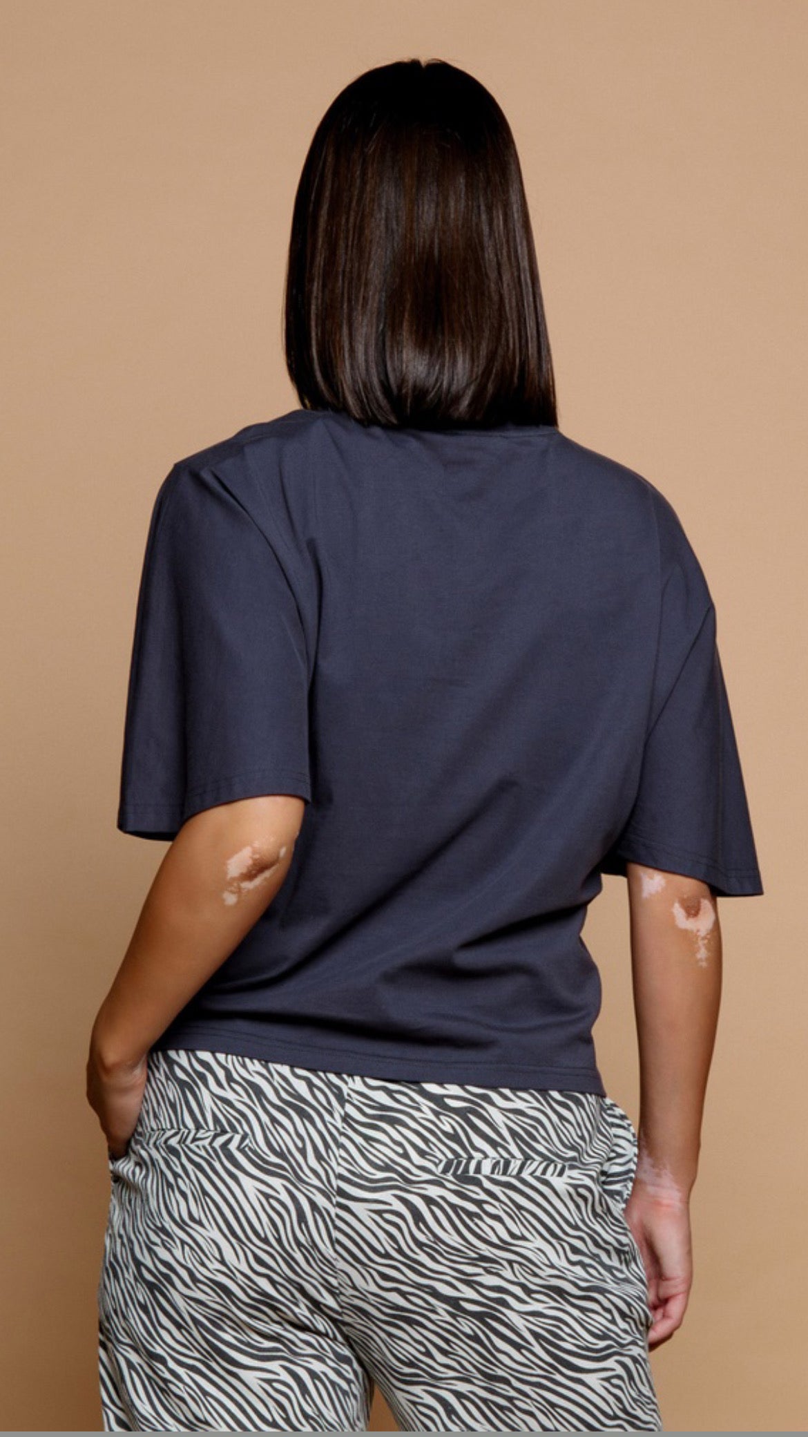 Tiger Top